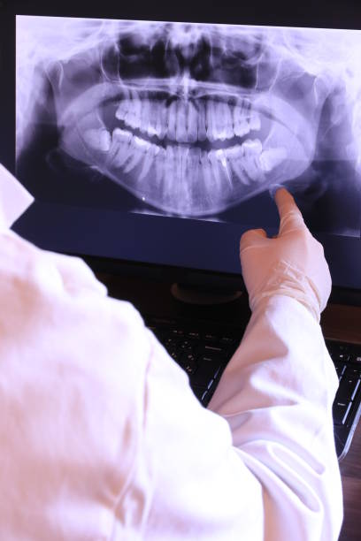 Best Emergency Wisdom Teeth Removal in Pembroke, VA