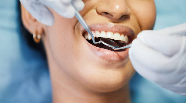 Best Emergency Tooth Extraction in Pembroke, VA